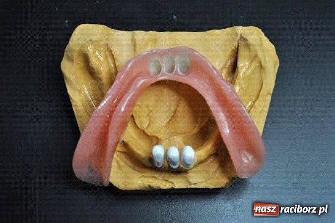 Zdjęcie w galerii na portalu naszraciborz.pl: Protezy teleskopowe – idealne rozwiązanie dla wymagających pacjentów wiadomości z regionu