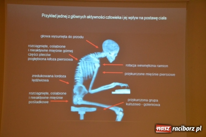 Zdjęcie w galerii na portalu naszraciborz.pl: Korygowanie wad postawy - konferencja na zamku  wiadomości z regionu