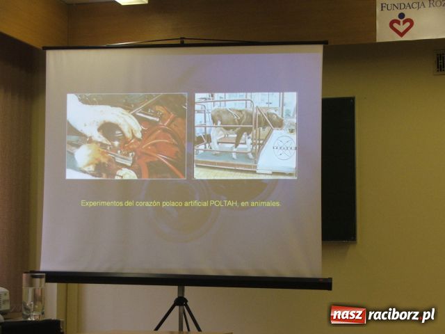Zdjęcie w galerii na portalu naszraciborz.pl: Sztuczne serce ratuje życie wiadomości z regionu