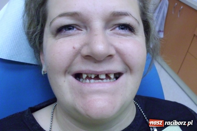 Zdjęcie w galerii na portalu naszraciborz.pl: Uśmiech Twoją wizytówką - zadbaj o niego w gabinetach ART-DENT wiadomości z regionu