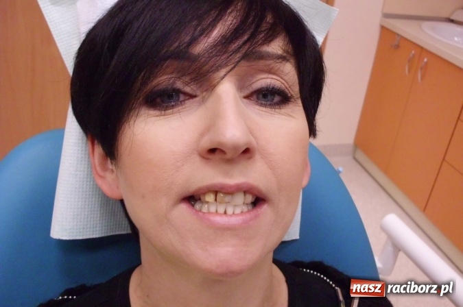 Zdjęcie w galerii na portalu naszraciborz.pl: Uśmiech Twoją wizytówką - zadbaj o niego w gabinetach ART-DENT wiadomości z regionu