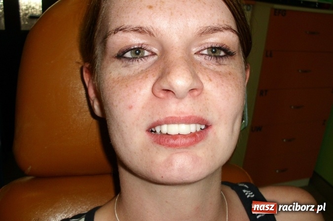 Zdjęcie w galerii na portalu naszraciborz.pl: Uśmiech Twoją wizytówką - zadbaj o niego w gabinetach ART-DENT wiadomości z regionu