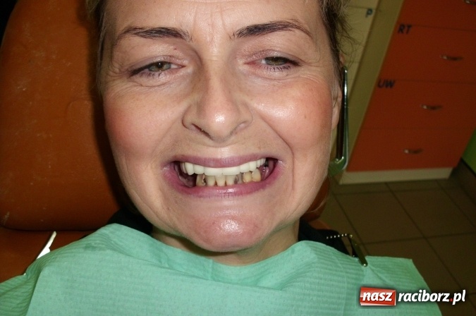 Zdjęcie w galerii na portalu naszraciborz.pl: Uśmiech Twoją wizytówką - zadbaj o niego w gabinetach ART-DENT wiadomości z regionu