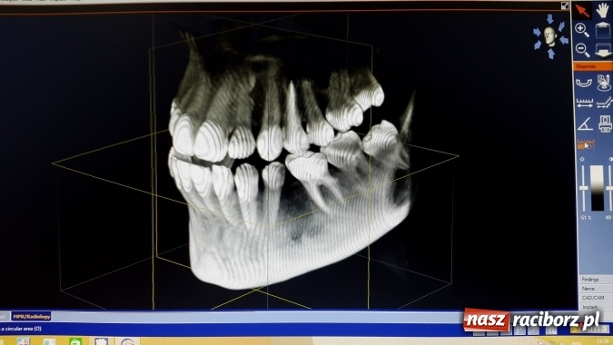 Zdjęcie w galerii na portalu naszraciborz.pl: Technologia 3D = Bezpieczeństwo wiadomości z regionu