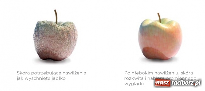 Zdjęcie w galerii na portalu naszraciborz.pl: MEZOTERAPIA - przygotuj skórę na lato wiadomości z regionu