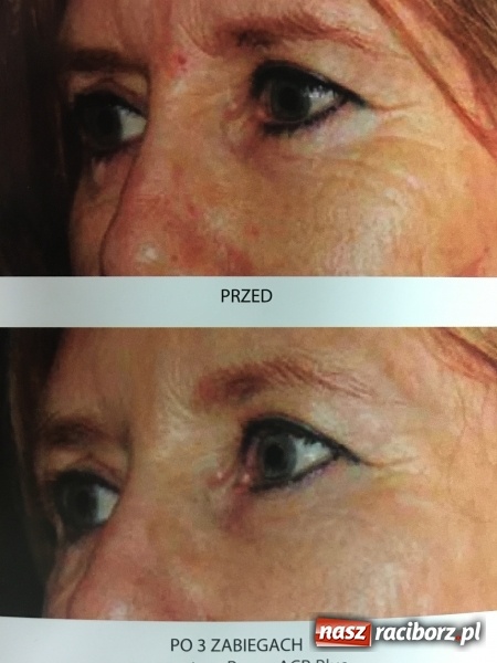 Zdjęcie w galerii na portalu naszraciborz.pl: Estetyka w medycynie wiadomości z regionu