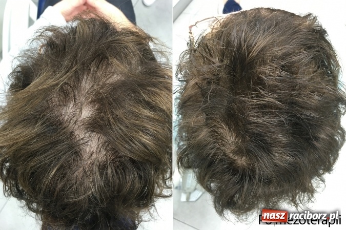 Zdjęcie w galerii na portalu naszraciborz.pl: Metamorfozy - stomatologia i medycyna estetyczna krok po kroku wiadomości z regionu