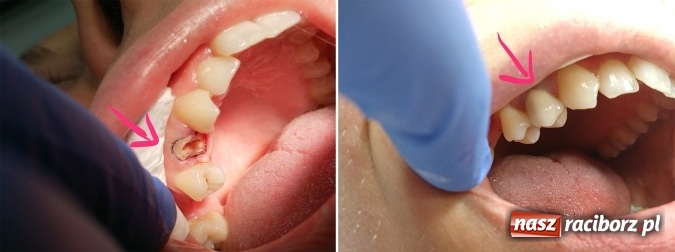 Zdjęcie w galerii na portalu naszraciborz.pl: Metamorfozy - stomatologia i medycyna estetyczna krok po kroku wiadomości z regionu