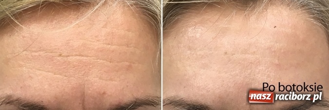 Zdjęcie w galerii na portalu naszraciborz.pl: Metamorfozy - stomatologia i medycyna estetyczna krok po kroku wiadomości z regionu