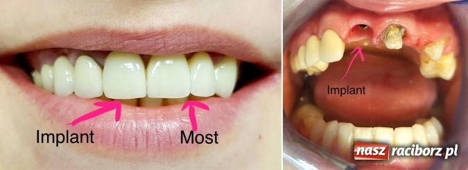 Zdjęcie w galerii na portalu naszraciborz.pl: Metamorfozy - stomatologia i medycyna estetyczna krok po kroku wiadomości z regionu