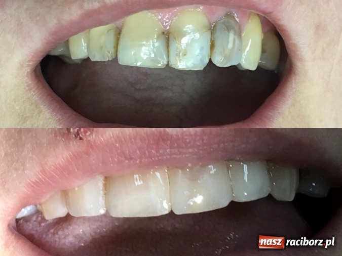 Zdjęcie w galerii na portalu naszraciborz.pl: Metamorfozy - stomatologia i medycyna estetyczna krok po kroku wiadomości z regionu