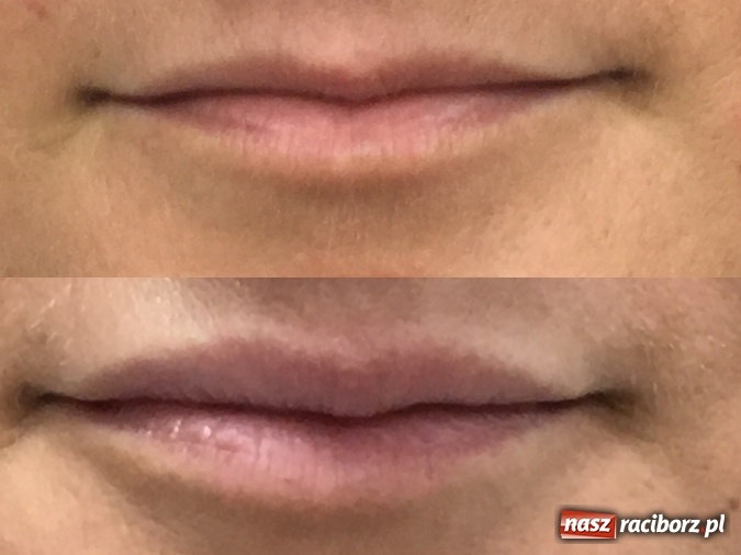 Zdjęcie w galerii na portalu naszraciborz.pl: Metamorfozy - stomatologia i medycyna estetyczna krok po kroku wiadomości z regionu