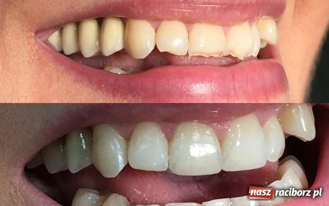 Zdjęcie w galerii na portalu naszraciborz.pl: Metamorfozy - stomatologia i medycyna estetyczna krok po kroku wiadomości z regionu