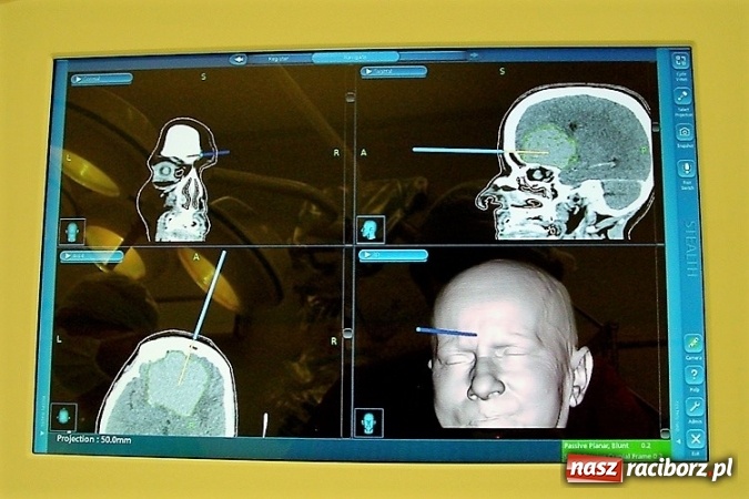 Zdjęcie w galerii na portalu naszraciborz.pl: Neuronawigacja dostępna na Śląsku wiadomości z regionu