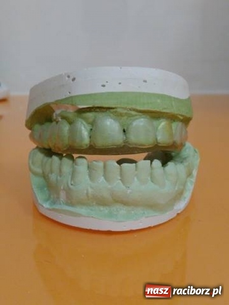 Zdjęcie w galerii na portalu naszraciborz.pl: Bruksizm. Co to jest i jak sobie z tym radzić? wiadomości z regionu