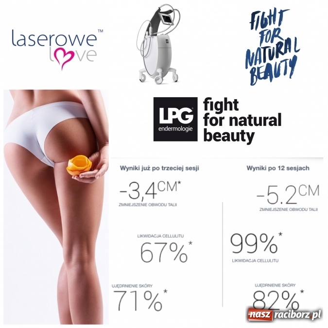 Zdjęcie w galerii na portalu naszraciborz.pl: Laserowe Love – z miłości do piękna i laserowych zabiegów wiadomości z regionu