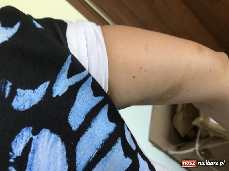 Zdjęcie w galerii na portalu naszraciborz.pl: 36-latka z Owsiszcz oskarża raciborskich policjantów o pobicie  wiadomości z regionu