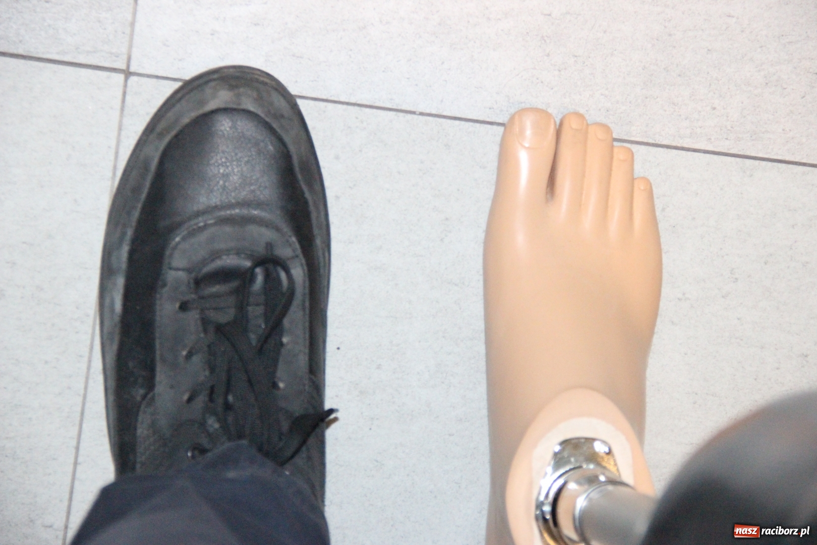 Zdjęcie w galerii na portalu naszraciborz.pl: Pierwsza pracownia protetyczna kończyn oraz warsztat ortopedyczny w Rybniku wiadomości z regionu