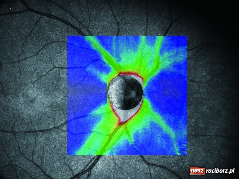 Zdjęcie w galerii na portalu naszraciborz.pl: Nowoczesne metody diagnostyczne oczu już dostępne w Raciborzu – zakład optyczny Michał Hula zaprasza! wiadomości z regionu
