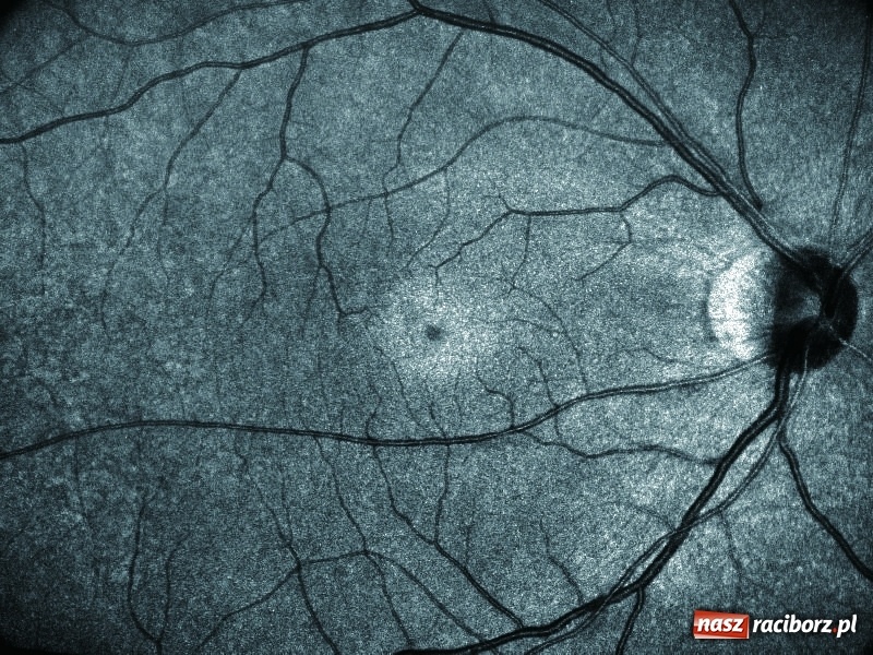 Zdjęcie w galerii na portalu naszraciborz.pl: Nowoczesne metody diagnostyczne oczu już dostępne w Raciborzu – zakład optyczny Michał Hula zaprasza! wiadomości z regionu