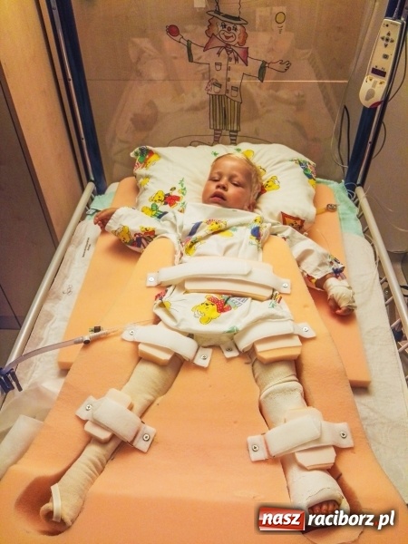 Zdjęcie w galerii na portalu naszraciborz.pl: Rafałek jest już po operacji. Pomogliście mu w maju  wiadomości z regionu