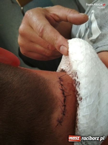 Zdjęcie w galerii na portalu naszraciborz.pl: Nożownik z Rud zatrzymany przez policję. Zaatakował podczas biesiady  wiadomości z regionu