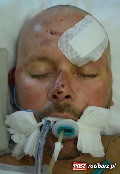 Zdjęcie w galerii na portalu naszraciborz.pl: Czy znasz tego człowieka? Po wypadku nie odzyskał przytomności wiadomości z regionu