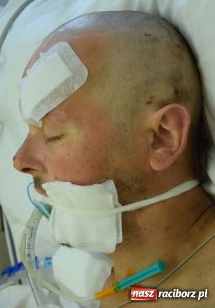 Zdjęcie w galerii na portalu naszraciborz.pl: Czy znasz tego człowieka? Po wypadku nie odzyskał przytomności wiadomości z regionu