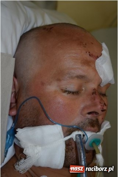 Zdjęcie w galerii na portalu naszraciborz.pl: Czy znasz tego człowieka? Po wypadku nie odzyskał przytomności wiadomości z regionu