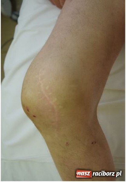 Zdjęcie w galerii na portalu naszraciborz.pl: Czy znasz tego człowieka? Po wypadku nie odzyskał przytomności wiadomości z regionu