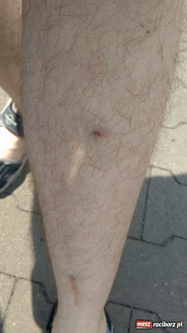 Zdjęcie w galerii na portalu naszraciborz.pl: Biedronka skontrolowała wózki w raciborskim markecie. Jeden z nich rozleciał się i zranił klienta  wiadomości z regionu