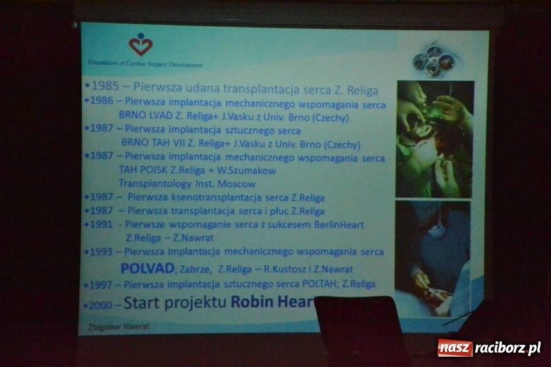 Zdjęcie w galerii na portalu naszraciborz.pl: Roboty medyczne Robin Heart i sztuczne serce - szanse i zagrożenia  wiadomości z regionu