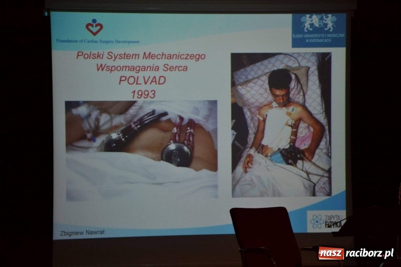 Zdjęcie w galerii na portalu naszraciborz.pl: Roboty medyczne Robin Heart i sztuczne serce - szanse i zagrożenia  wiadomości z regionu