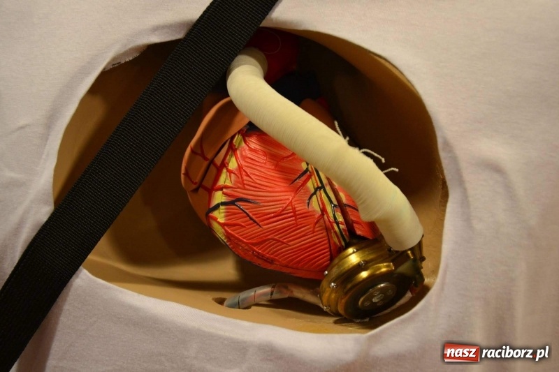 Zdjęcie w galerii na portalu naszraciborz.pl: Roboty medyczne Robin Heart i sztuczne serce - szanse i zagrożenia  wiadomości z regionu