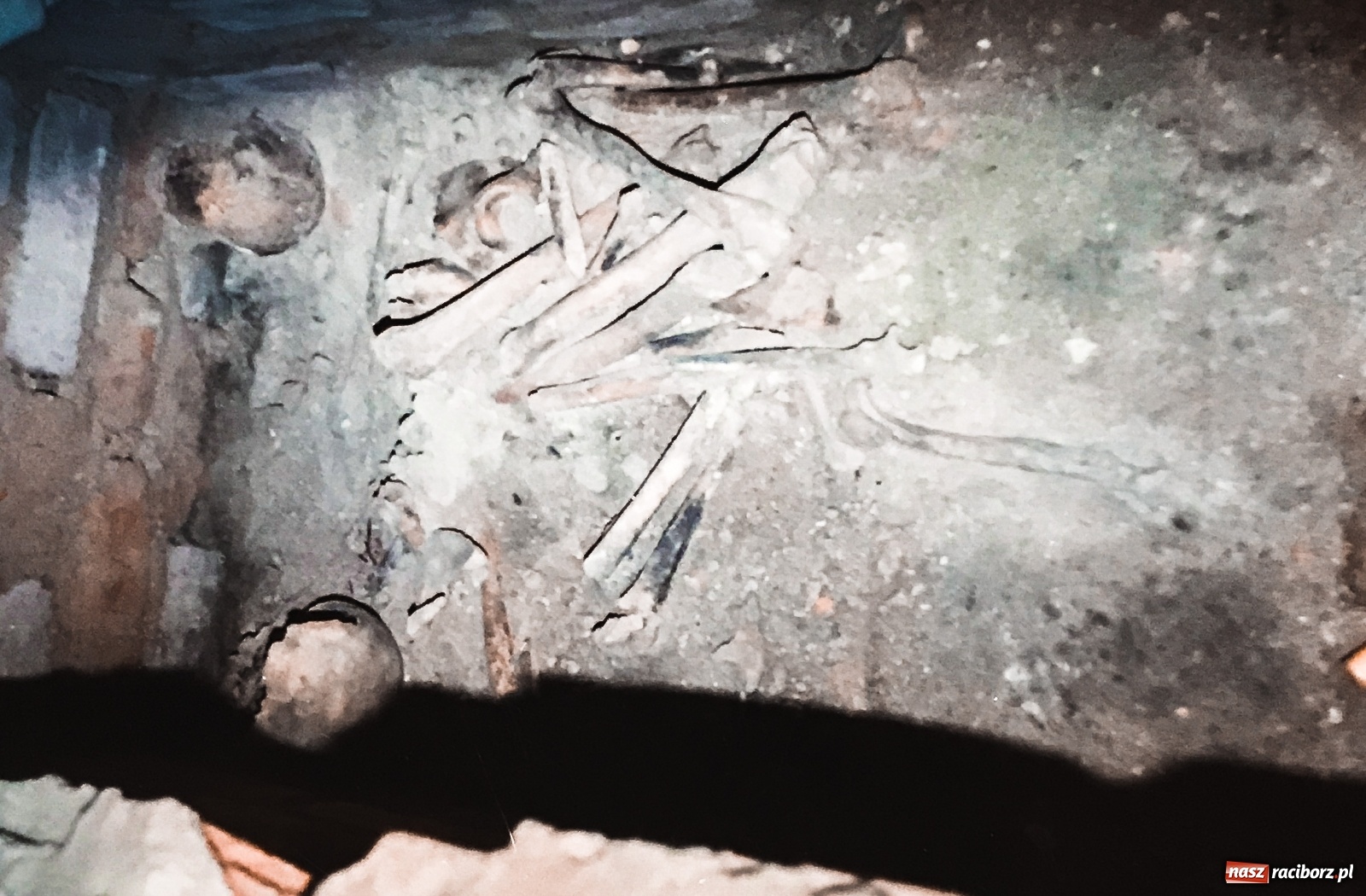 Zdjęcie w galerii na portalu naszraciborz.pl: Epidemie w dziejach Raciborza  wiadomości z regionu