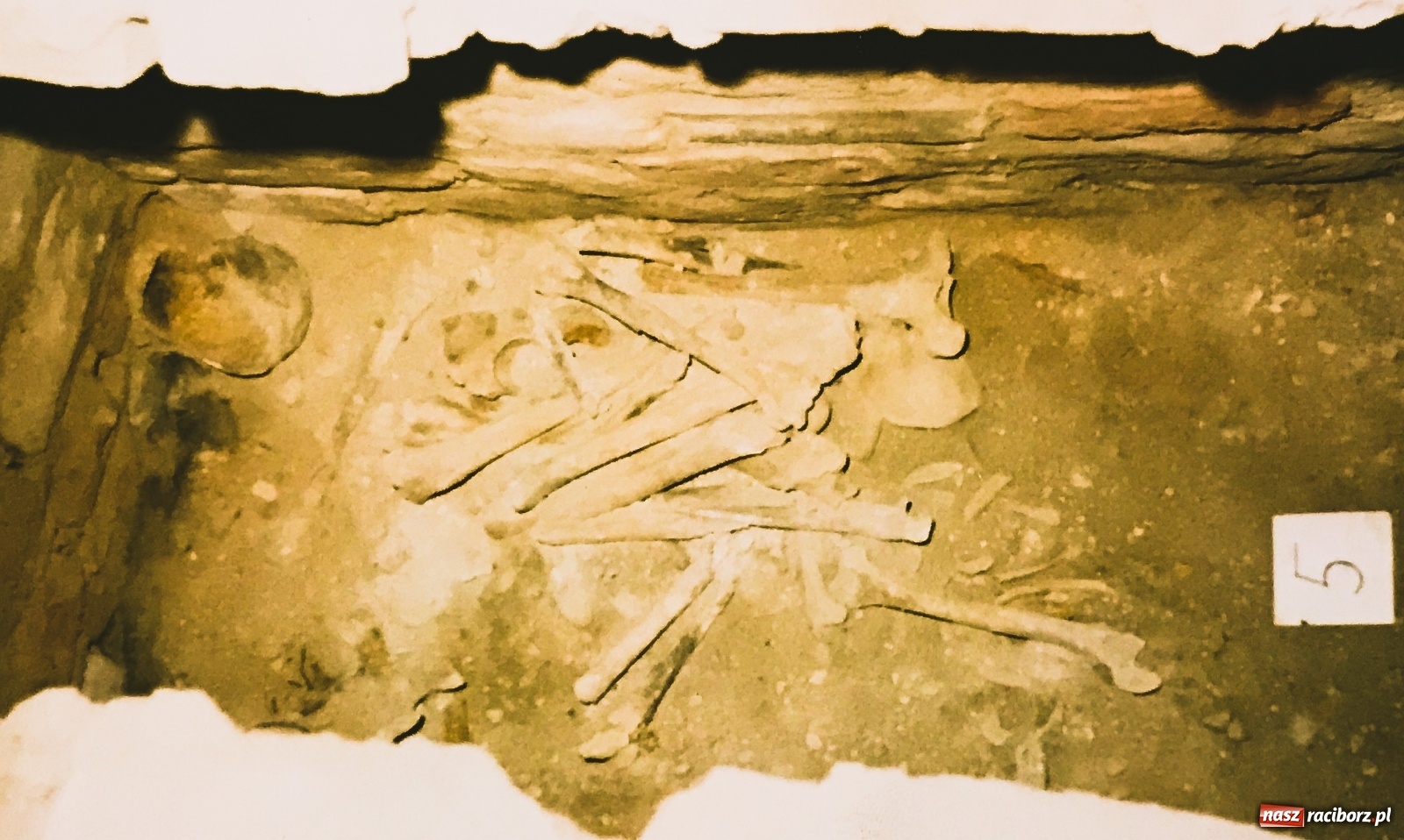 Zdjęcie w galerii na portalu naszraciborz.pl: Epidemie w dziejach Raciborza  wiadomości z regionu