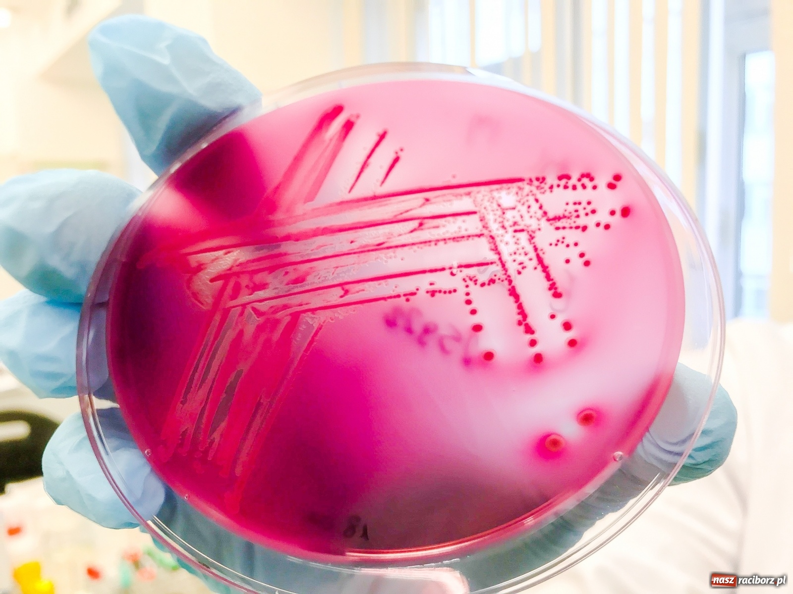 Zdjęcie w galerii na portalu naszraciborz.pl: Koniec złotej ery antybiotyków. W szpitalu widzą problem  wiadomości z regionu