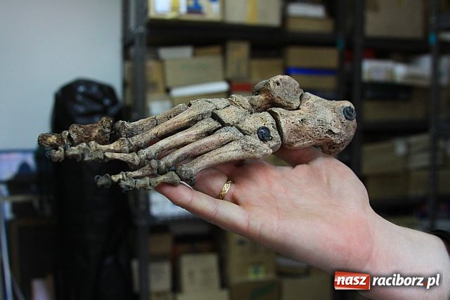 Zdjęcie w galerii na portalu naszraciborz.pl: Szkielet służył za pomoc w szkole? wiadomości z regionu