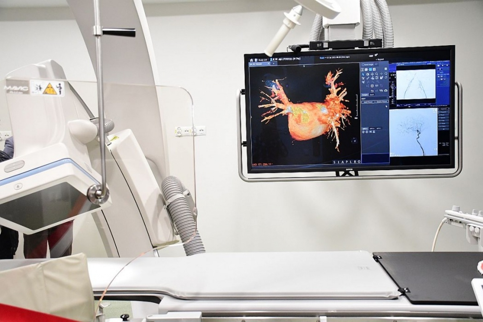 Zdjęcie w galerii na portalu naszraciborz.pl: Śląsk stawia na nowoczesną diagnostykę nowotworową wiadomości z regionu