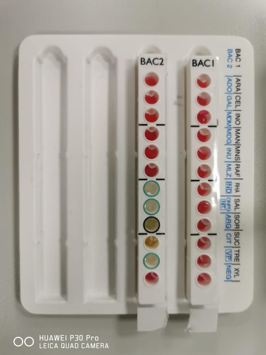 Zdjęcie w galerii na portalu naszraciborz.pl: Ekologia i mikrobiologia w CKZiU nr 1 Budowlanka - Gastronomik wiadomości z regionu