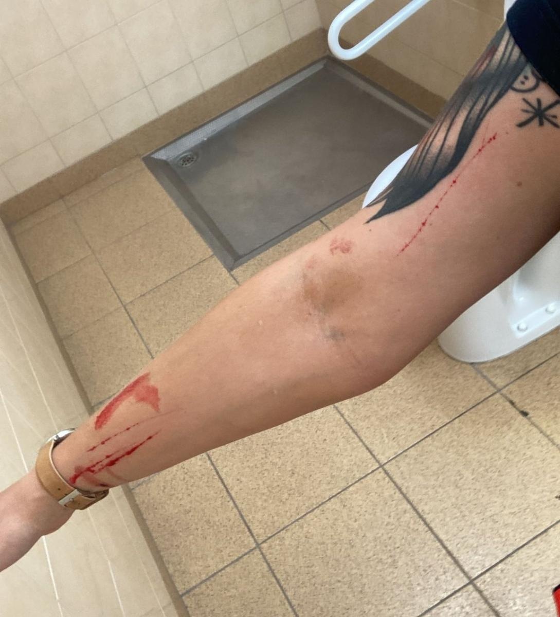 Zdjęcie w galerii na portalu naszraciborz.pl: Agresywny pacjent zaatakował ratowniczki medyczne z Raciborza wiadomości z regionu