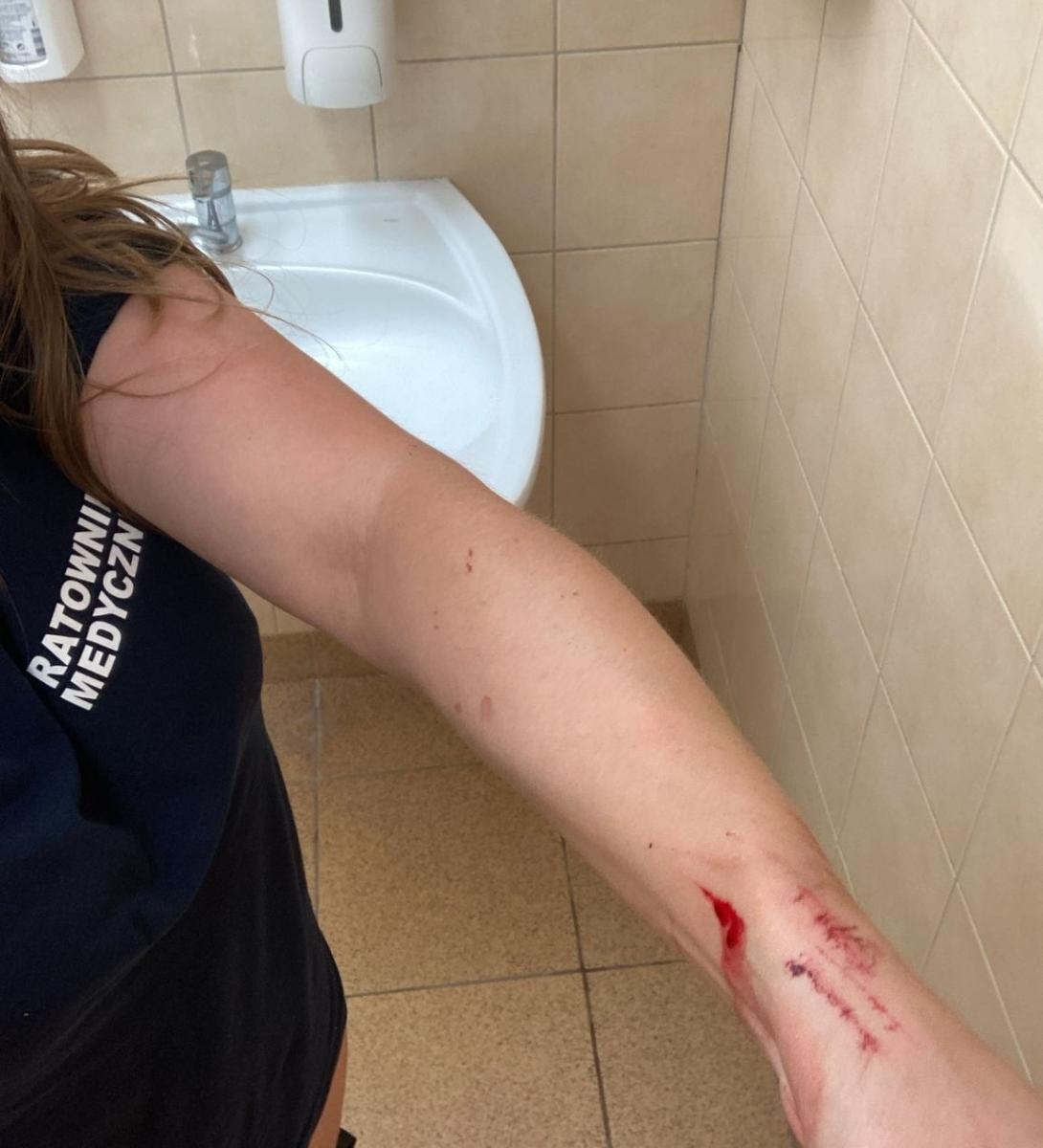 Zdjęcie w galerii na portalu naszraciborz.pl: Agresywny pacjent zaatakował ratowniczki medyczne z Raciborza wiadomości z regionu