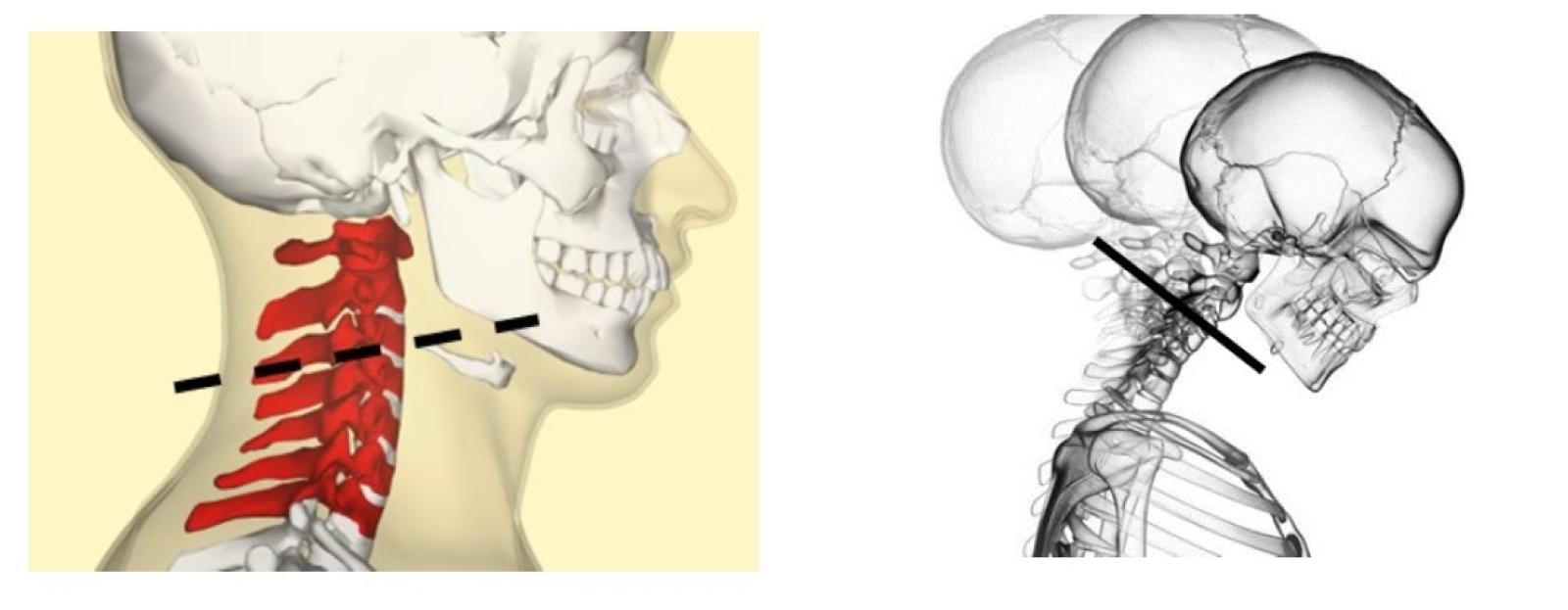 Zdjęcie w galerii na portalu naszraciborz.pl: Wystawa plenerowa Zapomniany cmentarz w Raciborzu wiadomości z regionu