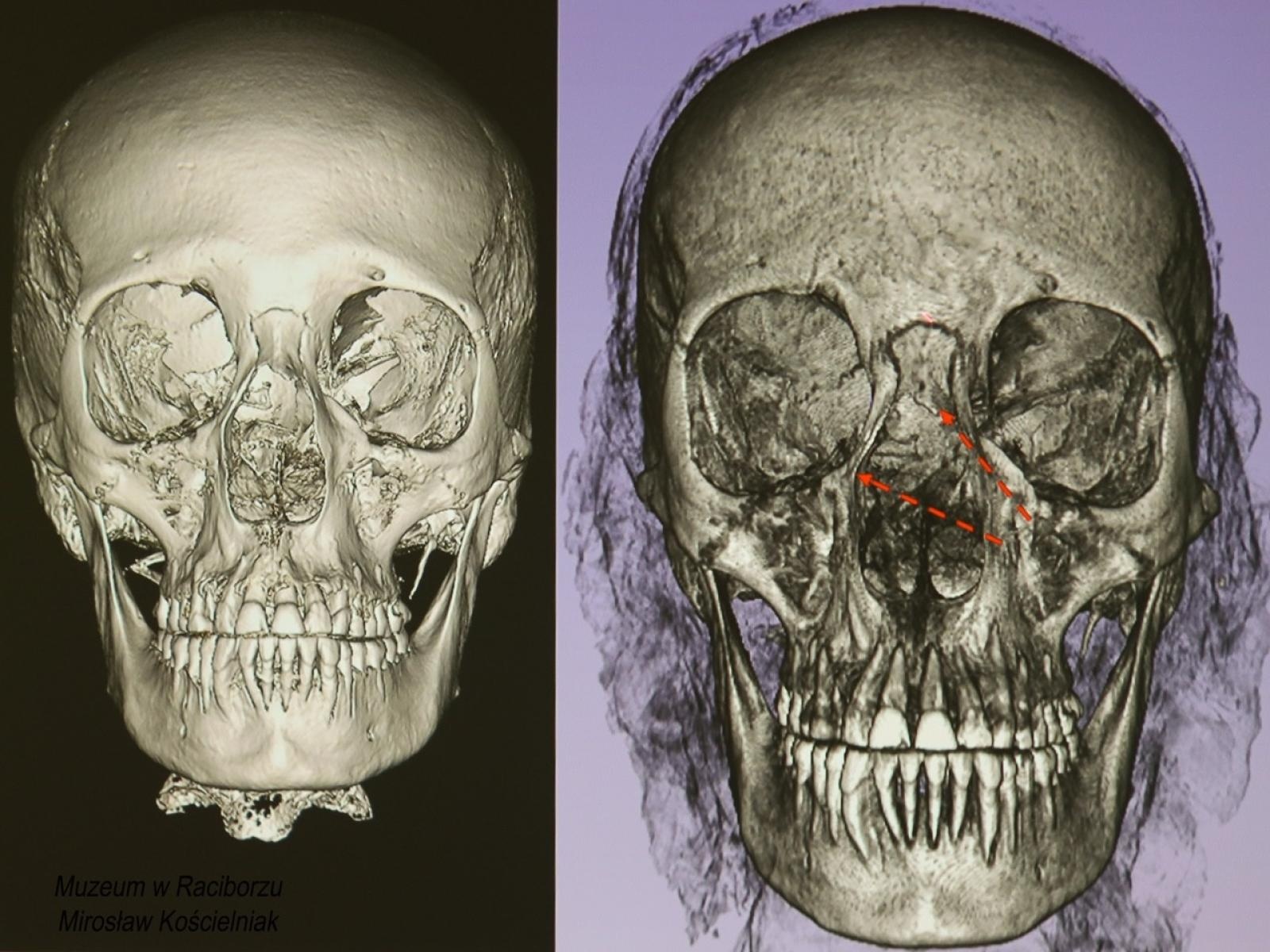 Zdjęcie w galerii na portalu naszraciborz.pl: Mumia z Raciborza w innym wymiarze. Muzeum szykuje atrakcję na ekspozycji wiadomości z regionu