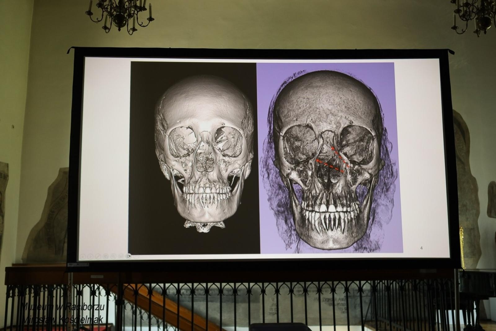 Zdjęcie w galerii na portalu naszraciborz.pl: Mumia z Raciborza w innym wymiarze. Muzeum szykuje atrakcję na ekspozycji wiadomości z regionu