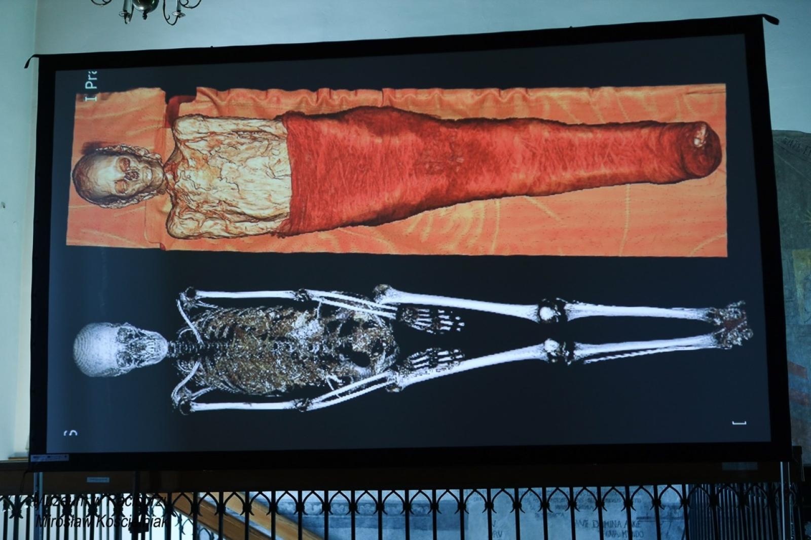 Zdjęcie w galerii na portalu naszraciborz.pl: Mumia z Raciborza w innym wymiarze. Muzeum szykuje atrakcję na ekspozycji wiadomości z regionu