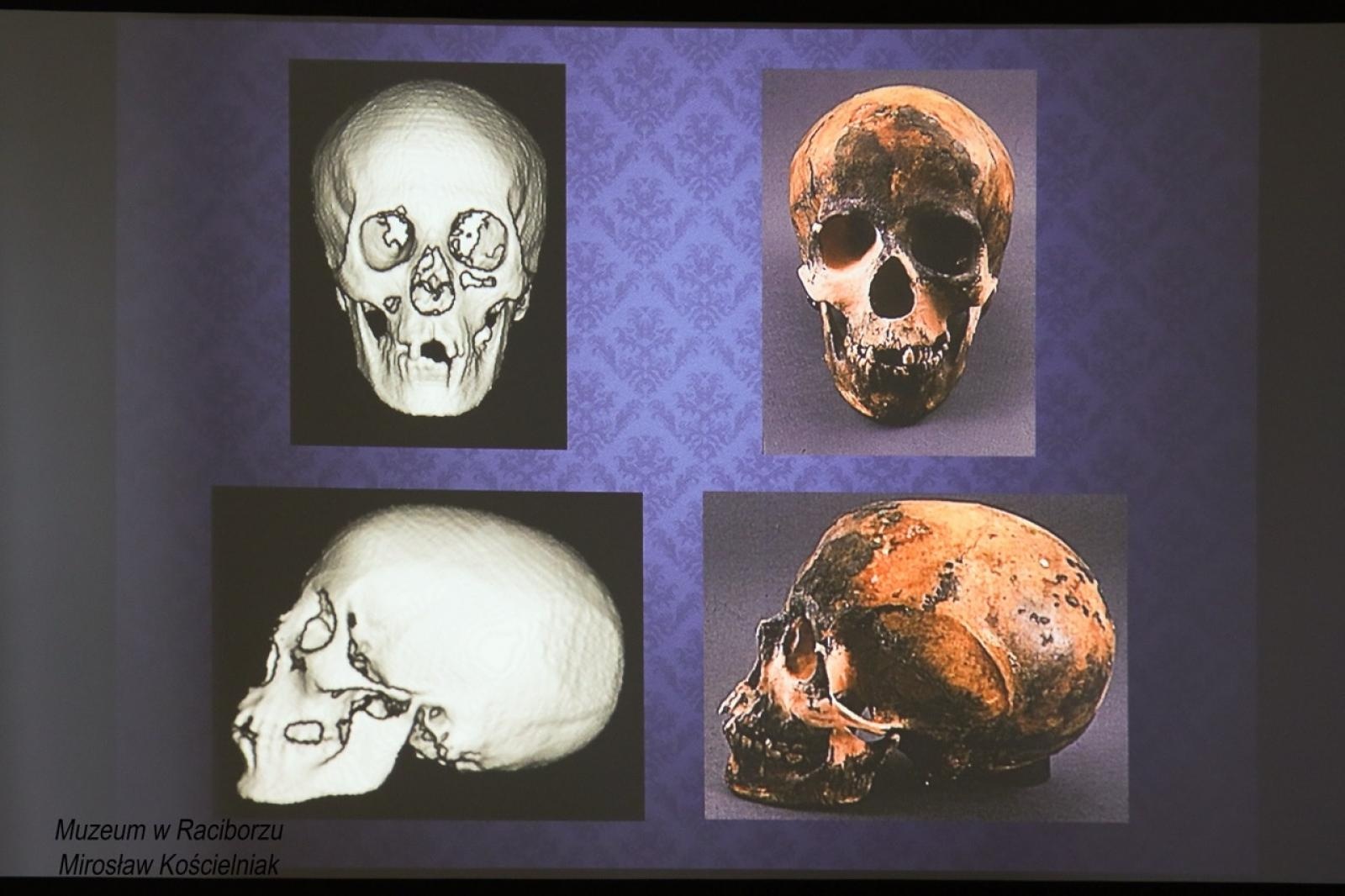 Zdjęcie w galerii na portalu naszraciborz.pl: Mumia z Raciborza w innym wymiarze. Muzeum szykuje atrakcję na ekspozycji wiadomości z regionu