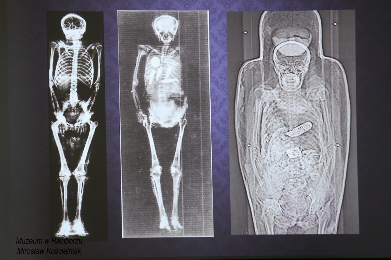 Zdjęcie w galerii na portalu naszraciborz.pl: Mumia z Raciborza w innym wymiarze. Muzeum szykuje atrakcję na ekspozycji wiadomości z regionu