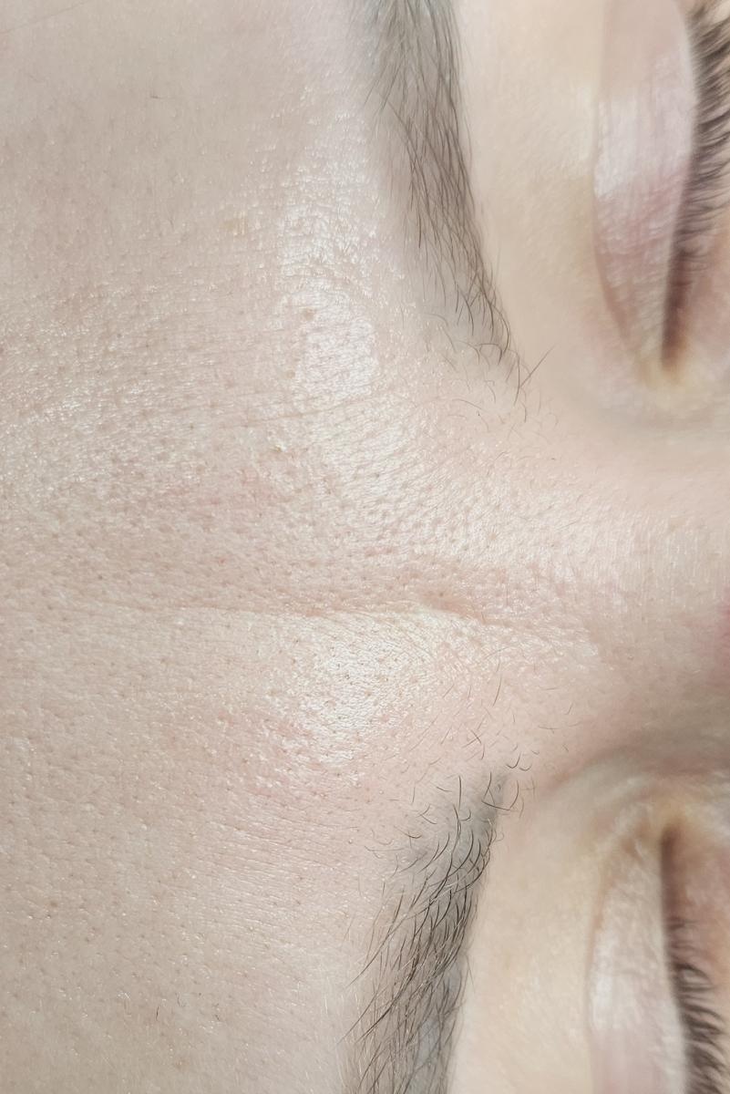 Zdjęcie w galerii na portalu naszraciborz.pl: Specjalistyczne terapie blizn w DW. Studio Urody Dominika Wallach, Racibórz ul. Kozielska 24A wiadomości z regionu