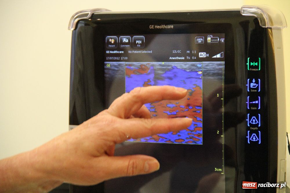 Zdjęcie w galerii na portalu naszraciborz.pl: Jedyny taki aparat w Polsce! wiadomości z regionu